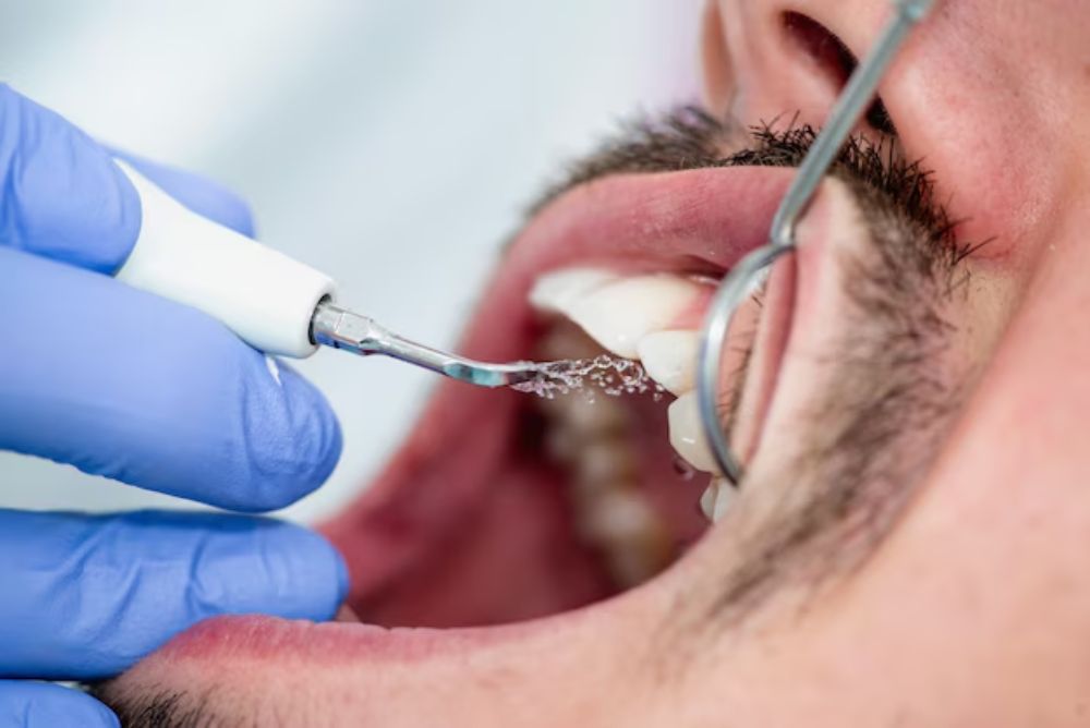 save-time-and-money-with-regular-dental-cleanings